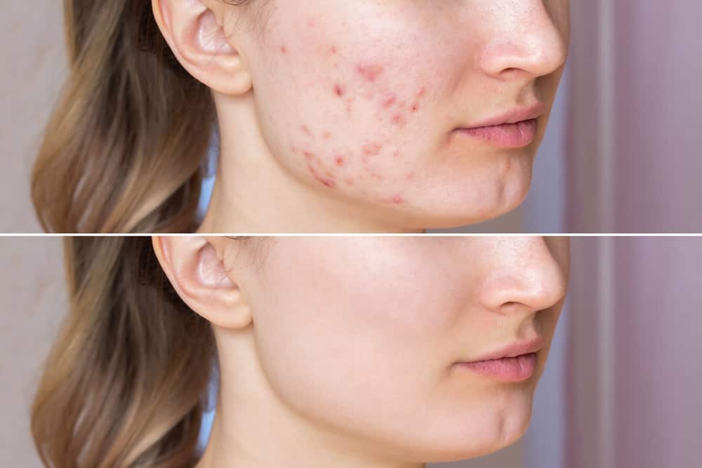 công dụng Klenzit Ms và Klenzit C