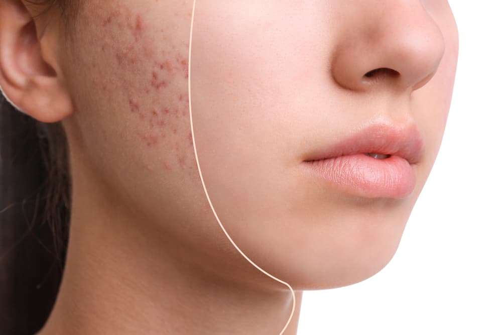 công dụng Megaduo và Derma Forte