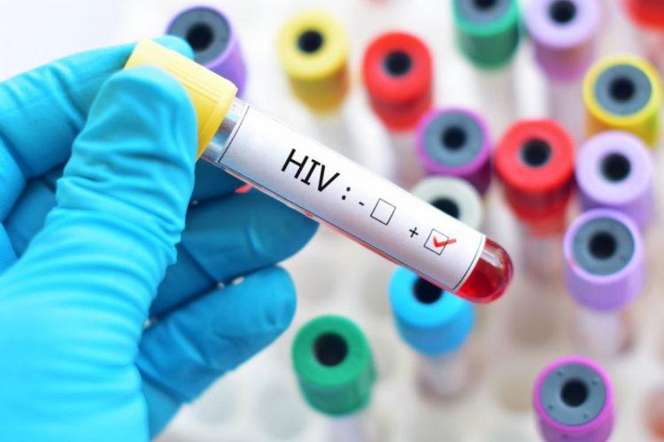 hiv-e1541749420541 Lamivudine